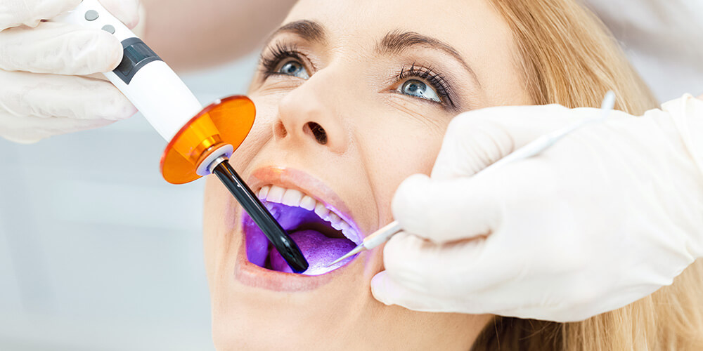 Dental Bonding Pasco