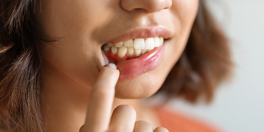 Periodontal Therapy Pasco