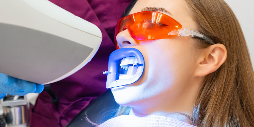 Teeth Whitening Pasco